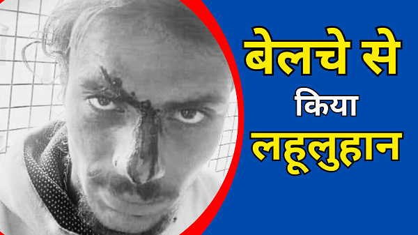 Chamba: Brother and sister attacked with shovel, dispute over road